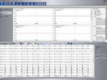 Sistema de Ergometría Cardiovex EU13 - Imagen 3