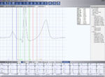 Holter Cardiovex MMC10D - Imagen 2